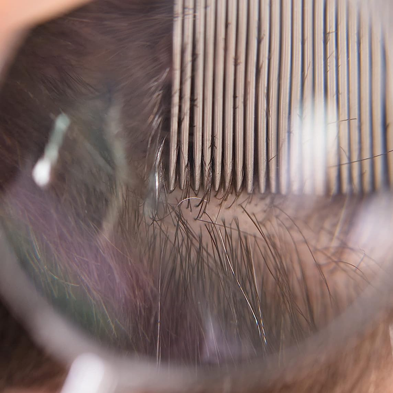 Option+ Lice Comb Kit - Comb Magnifier Tweezer | 1 Pack