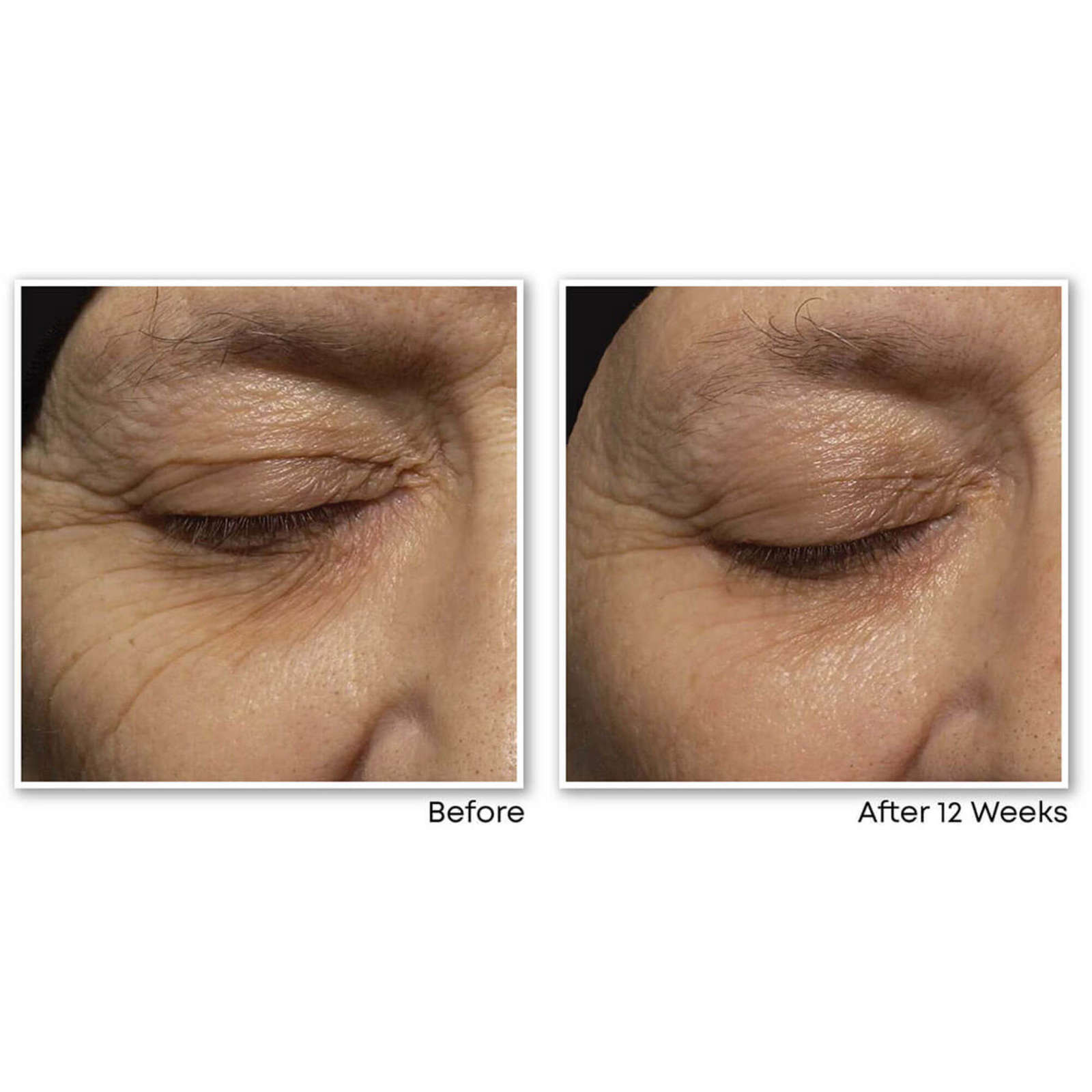 Retinol Correxion Deep Wrinkle Night Cream
