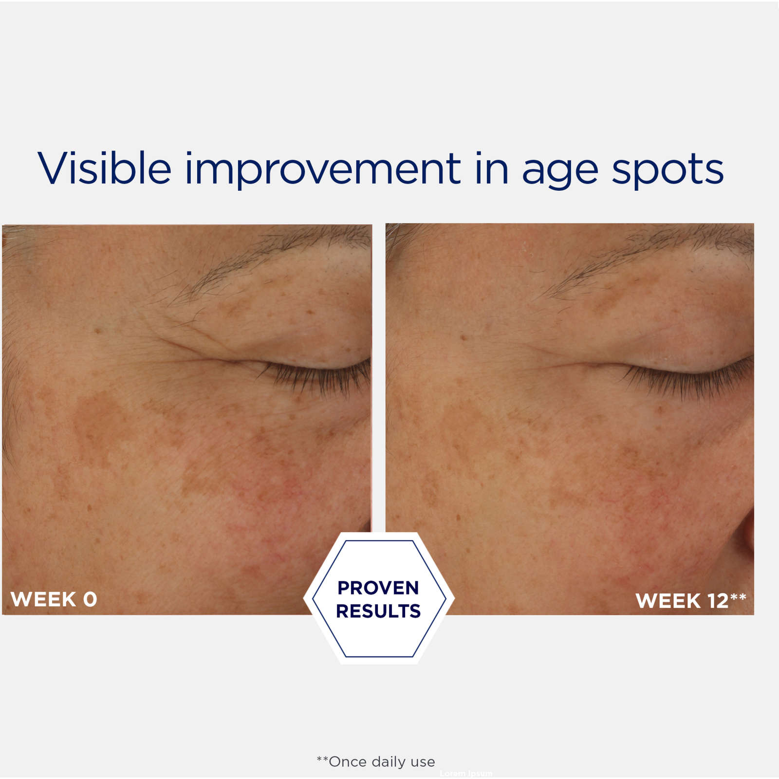 Potent Retinol Complex