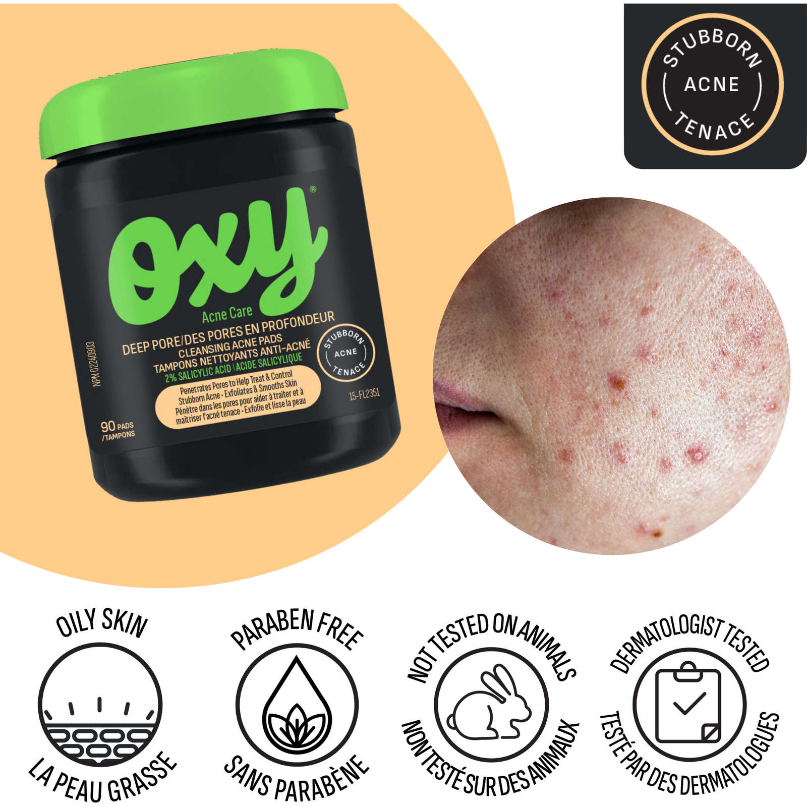 Deep Pore Cleansing Acne Pads with Salicylic Acid, For Stubborn Acne, For Blackheads and Visible Pores