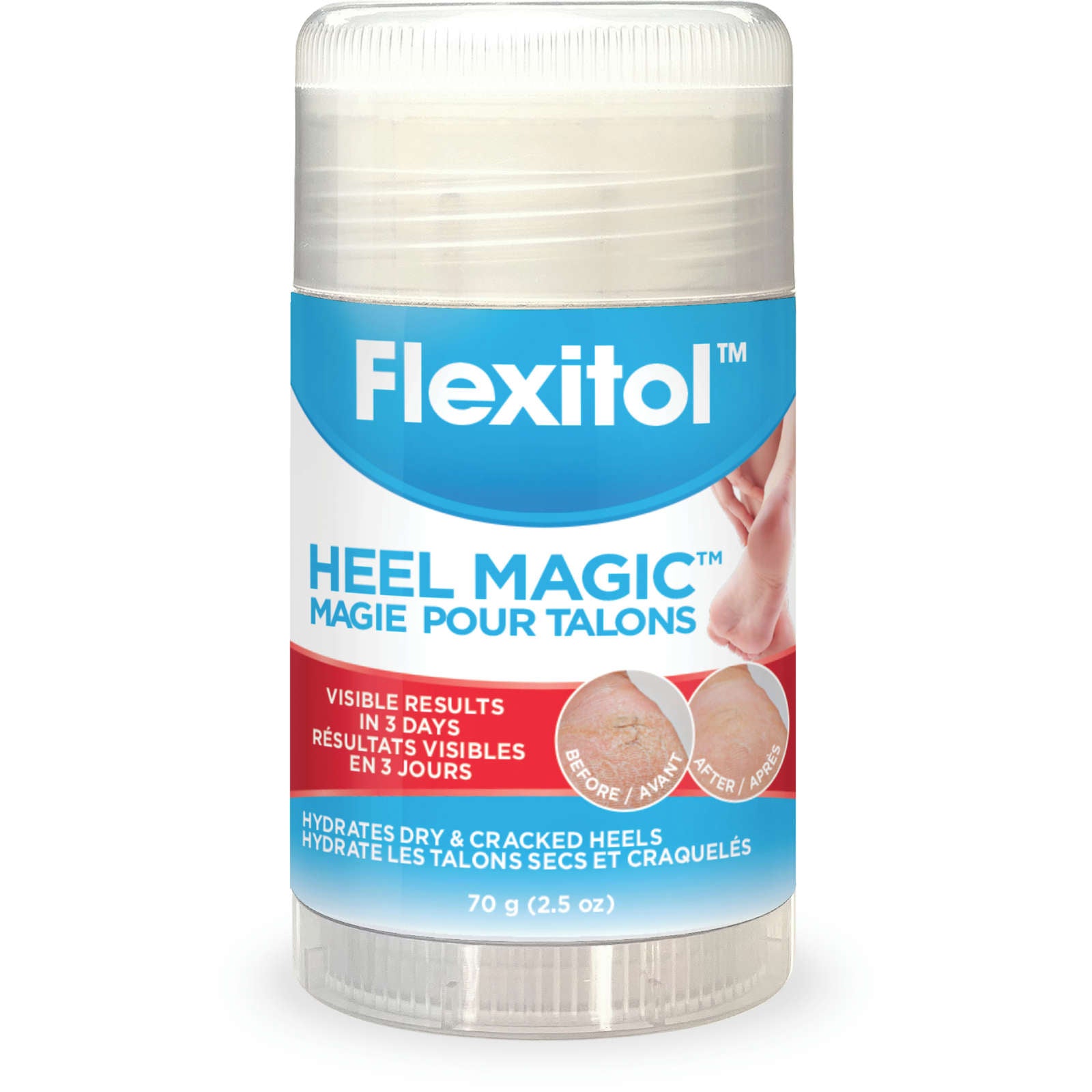 Heel Magic 70 g