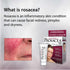 Rosacea Treatment Gel