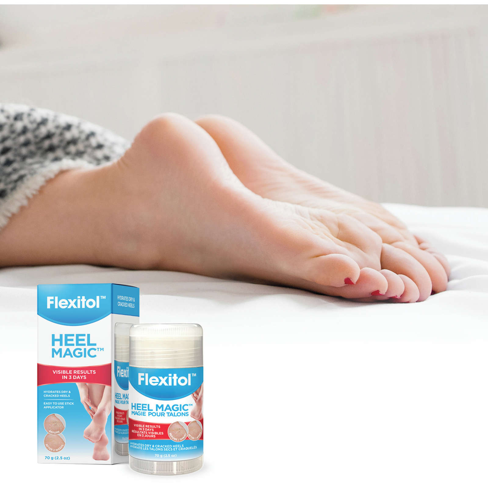 Heel Magic 70 g
